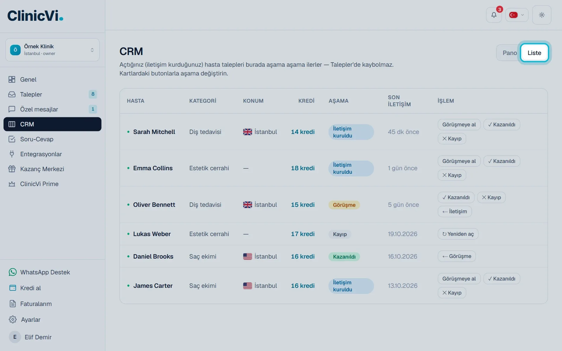 CRM Liste görünümü ve işaretli Liste düğmesi