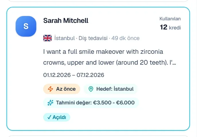 Listede ✓ Açıldı etiketli talep kartı